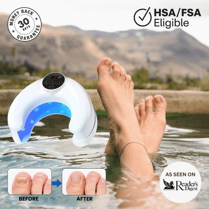 ClearNail Pro Curve™ - Nail Fungus Laser Device