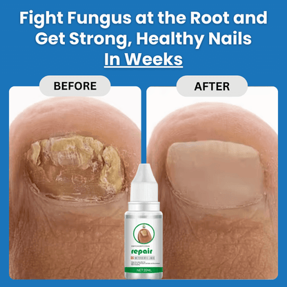 ClearNail™ Fungus Ointment