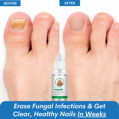 ClearNail™ Fungus Ointment