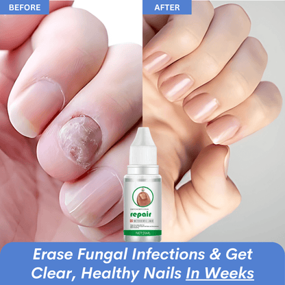ClearNail™ Fungus Ointment