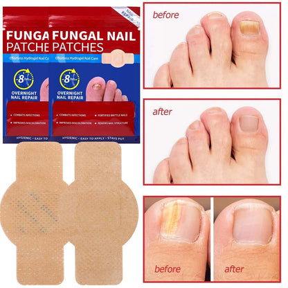 ClearNail Pro™ - Nail Fungus Patches
