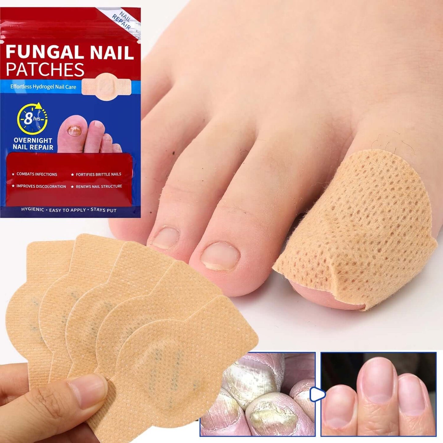 ClearNail Pro™ - Nail Fungus Patches