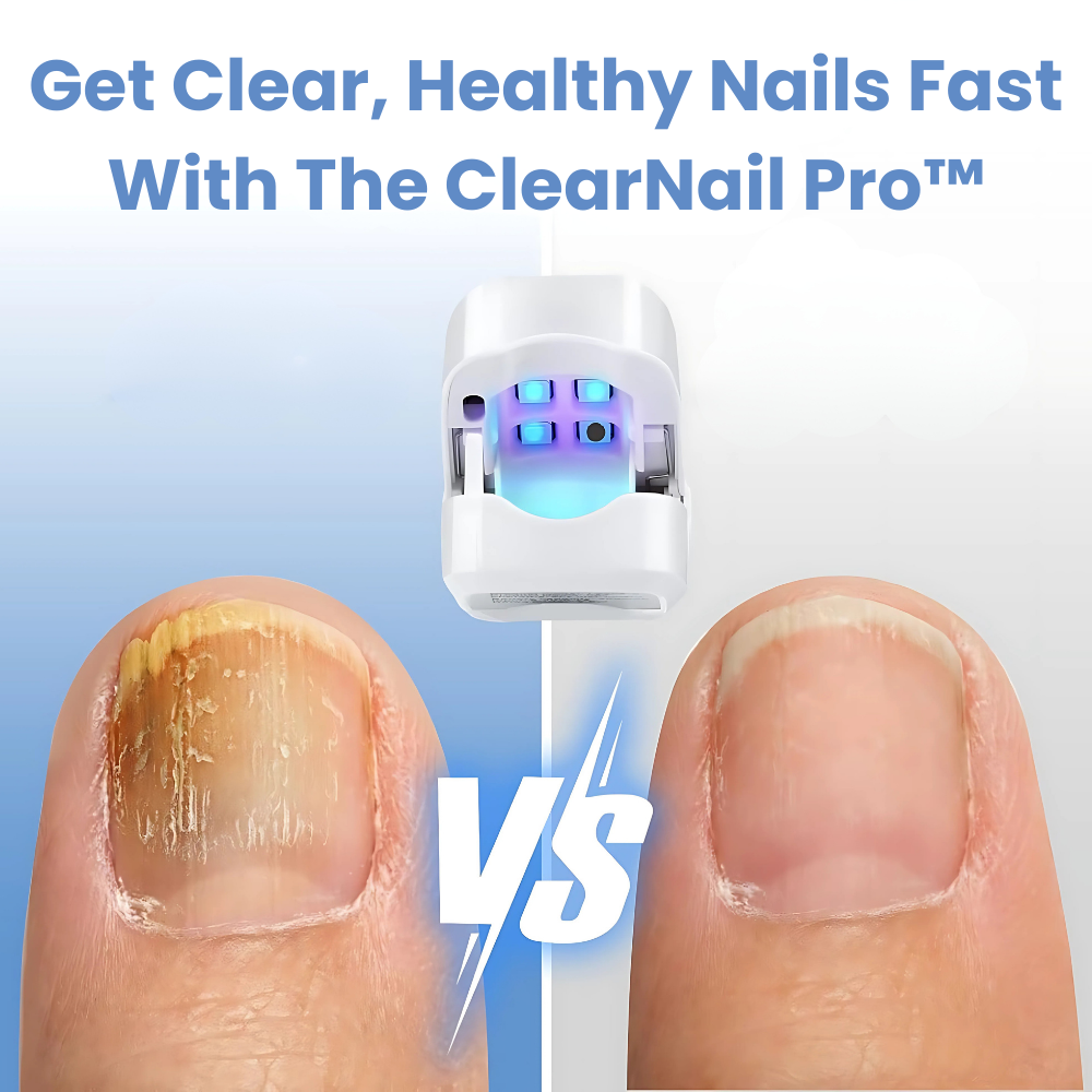 Get Clear, Healthy Nails Fast